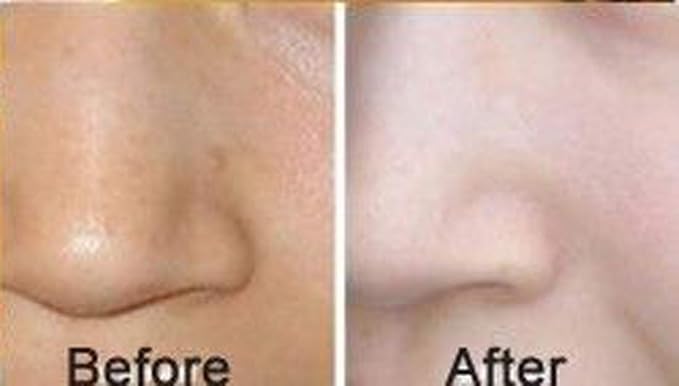 Luxurious 24k Gold Bio-collagen Facial Mask (5pcs)