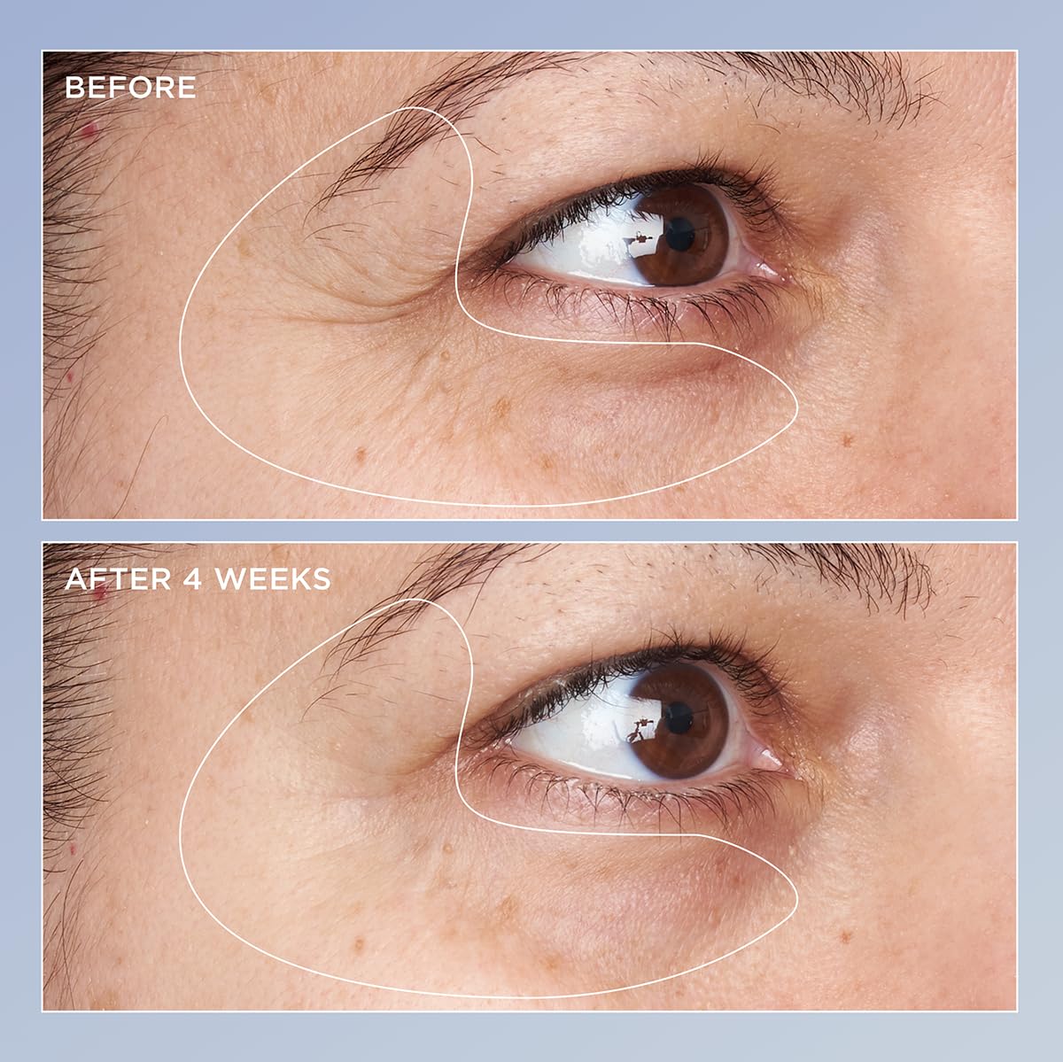 TIAM Vita A Bakuchiol Firming Eye Cream for Wrinkles, Anti-Aging, Dark Circles, and Puffiness, Fragrance-Free Under-Eye Treatment, 1.01 FL.OZ. / 30ml