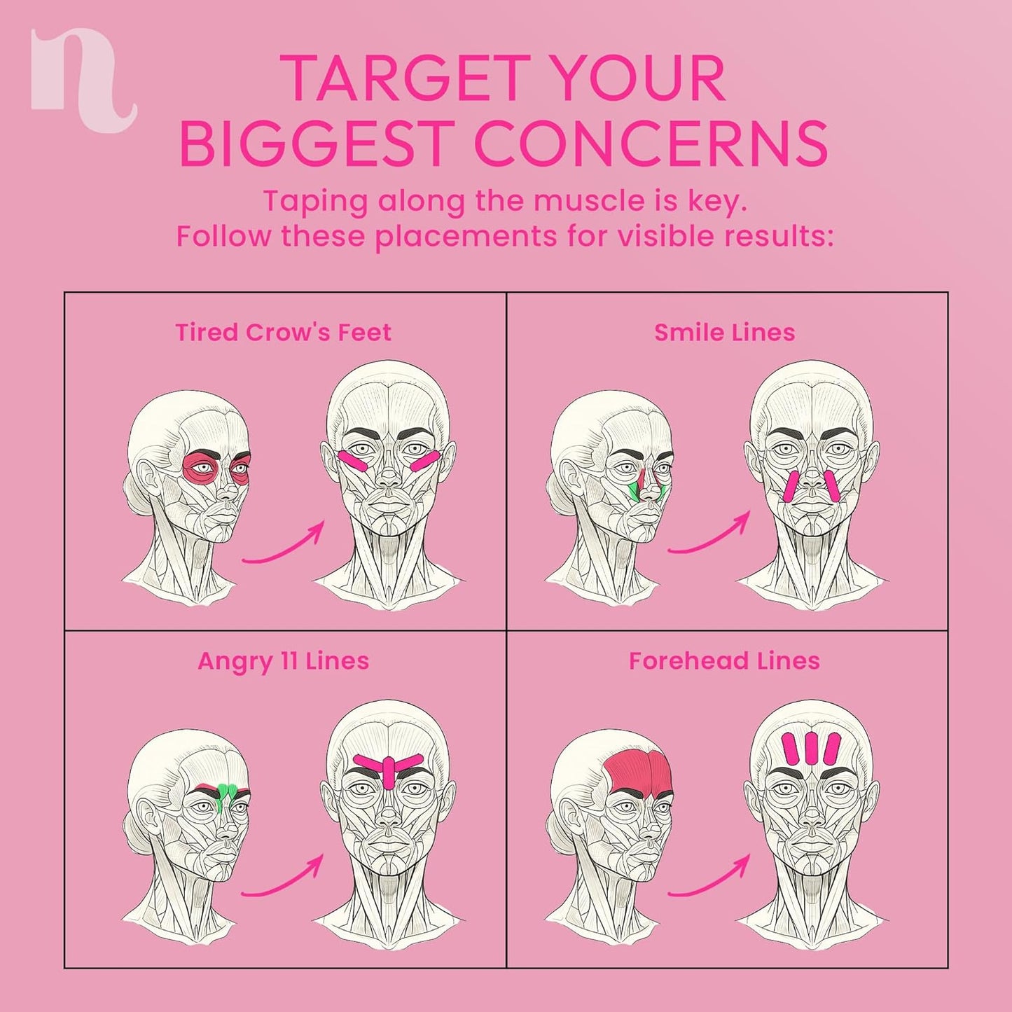 Anti Wrinkle Patches for Women - Forehead, Smile Line, Face Lifting Tape - Overnight Facial Lift - Pre-Cut Kinesiology Face Tape in 2 Sizes - Skin Safe, Latex-Free