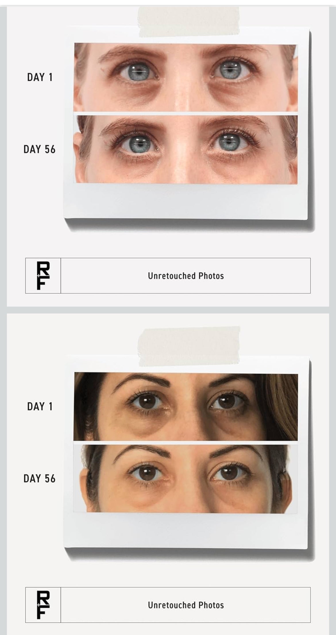 RODAN + FIELDS Active Hydration Bright Eye Complex | 15ml | Moisturizing Under Eye Cream for Dry Skin | Brightening Eye Treatment | Skincare