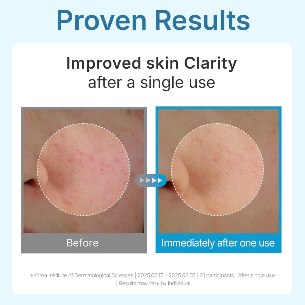 CENTELLIAN 24 Madeca Lab Hyal Waterfull Gel Mask (Hydrating Gel Mask, 4 pcs) – Deep Moisture & Cooling Sheet with 10-Layer Hyaluronic Acid, Korean Skin Care. TECA, Glycerin, Niacinamide.