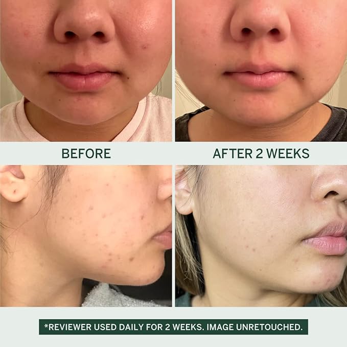 Urban Calm Collection - Fermented Skincare Bundle - for All Skin Types - Anti-Aging Skincare Set for Hydrating, Firming, Exfoliating, Soothing - With Cleanser, Essence, Serum, and Cream