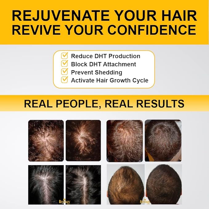 Revivogen MD Scalp Therapy Thinning Hair Solution, Shampoo & Conditioner Set