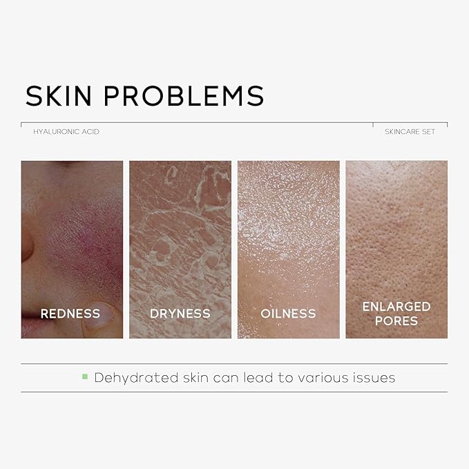 Skin Care Set, Hyaluronic Acid Travel Size Skincare Set W/ Low pH Cleanser, Moisturizer, Serum, Eye Cream, Toiletry Bag, Face Care Set Gift for Women Girls, Hydrating Anti Aging for Dry Skin