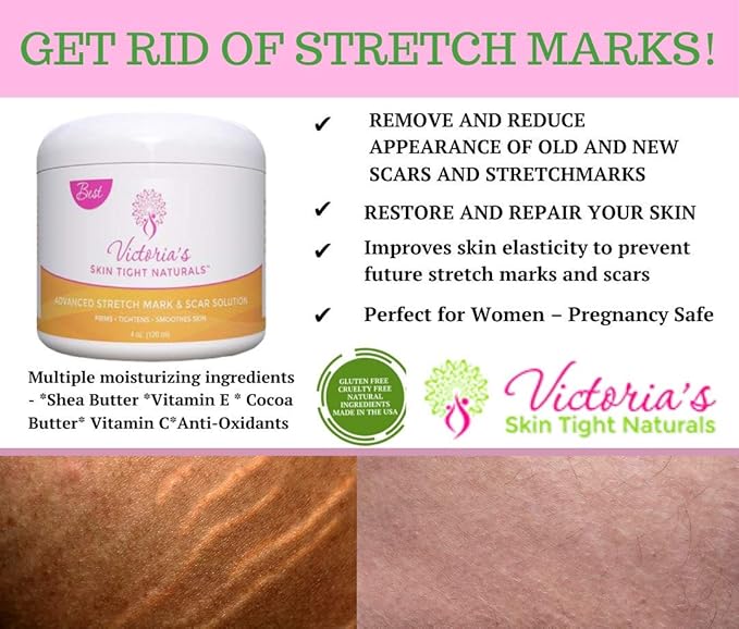 Best Stretch Marks Cream Prevent & Reduce Marks Reduce Pregnancy Stretch Marks Highly Concentrated Cream includes $29 Scar Reducing Guide