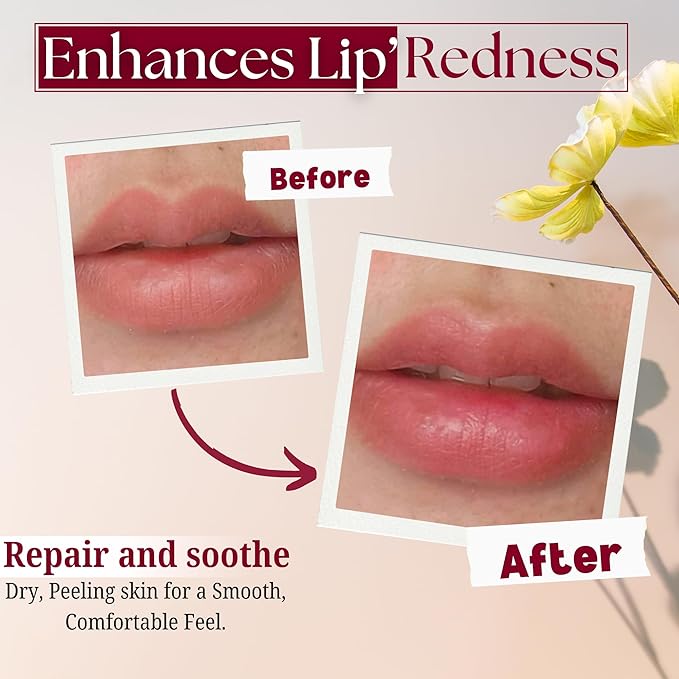 Merlena Pink Lip & Nip Serum - Hydrates and Repairs Dry, Peeling Lips and Nipples, Adds Collagen for Plumpness, Soothes Flaky Skin, Organic Vitamin C & E Formula 8ml