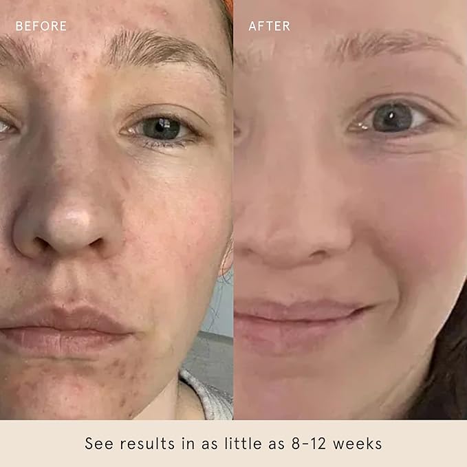 Barefaced Glow Peel Pads (60 Count) - Deep Exfoliating Face & Body Pads with 15% Glycolic Acid, Squalane & Vitamin E - Smooths Texture, skincare