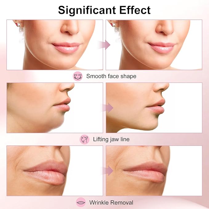 2025 Multi-Functional Face Lifting Device, V Roller Face Lift, Tightening, Skin Care, Double-Sided Roller Design, Type-C Fast Charging, Portable Beauty Device with 3 Adjustable Settings (White)