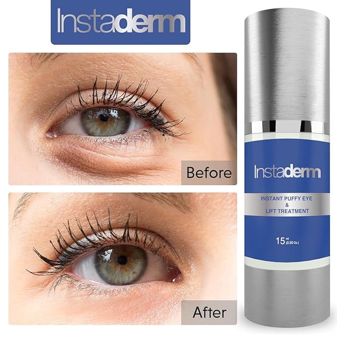 Instant Puffy Eye & Lift Treatment – Removes Under Eye Bags & Puffiness. Eliminate Dark Circles & Wrinkles. Naturally Ageless Hydrating Cream. Disappears Before Your Eyes Within Minutes.