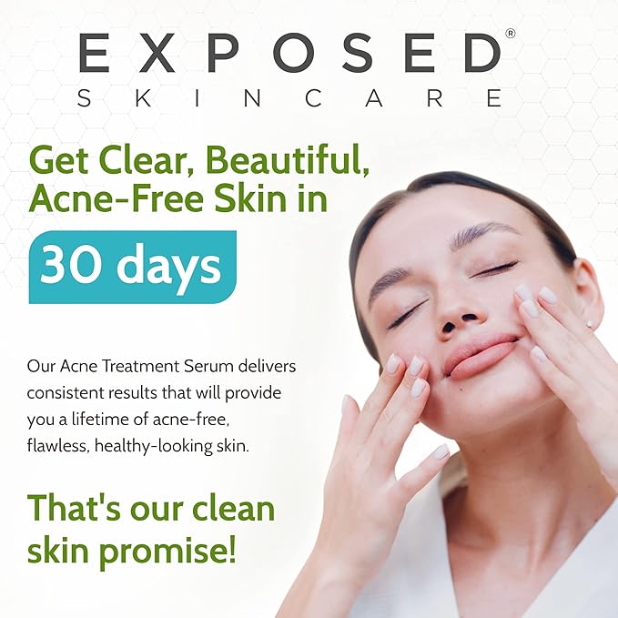 Exposed Skin Care Acne Treatment Serum Step 3 – Quickly Reduces Pimple Size and Redness - 12 Hour Spot Treatment - 3.5% Benzoyl Peroxide, Natural Green Tea & Tea Tree Oil