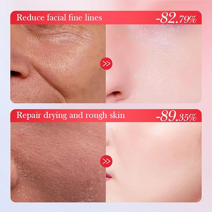 Goji Berry Skincare Sets, 6 In 1 Complete Facial Care Kit Antioxidant, Anti Aging Skin Care Set For Tighten, Lift & Reduce Wrinkles, Goji Berries Face Care Set For Women, Beauty Gift Set For Girls