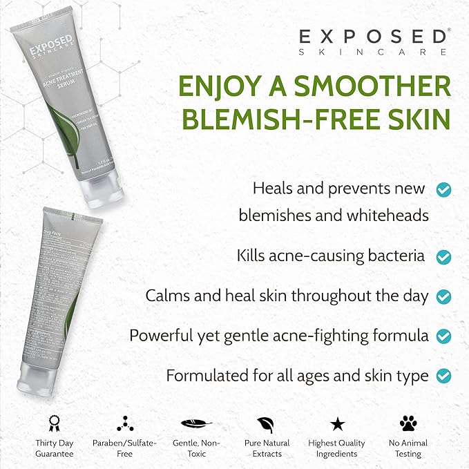 Exposed Skin Care Acne Treatment Serum Step 3 – Quickly Reduces Pimple Size and Redness - 12 Hour Spot Treatment - 3.5% Benzoyl Peroxide, Natural Green Tea & Tea Tree Oil