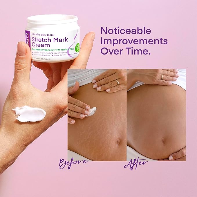 Stretch Mark Cream for Pregnancy: Stretch Mark Treatment - Belly Butter For Pregnant Women - Massage Lotion To Prevent And Repair Maternity Stretch Marks Scar - 4 Oz
