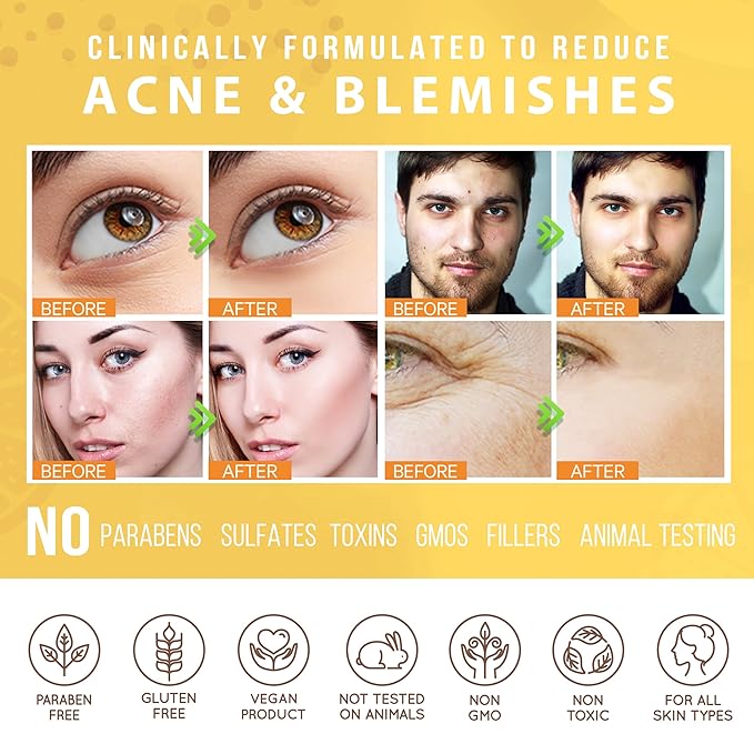 LILY SADO HONEY WALNUT Creamy Face Scrub - Best Exfoliating Facial Cleanser for Women & Men - Gently Exfoliates, Softens & Energizes Skin, Treats Acne, Reduces Pore Size - For All Skin Types - 4 oz