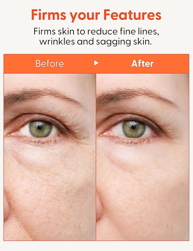 It'S SKIN Collagen Nutrition Emulsion - Marine Collagen Volume & Firming Facial Lotion, Intense Revitalizing & Elasticity for Rough and Aging Skin, 5.07 fl.oz.