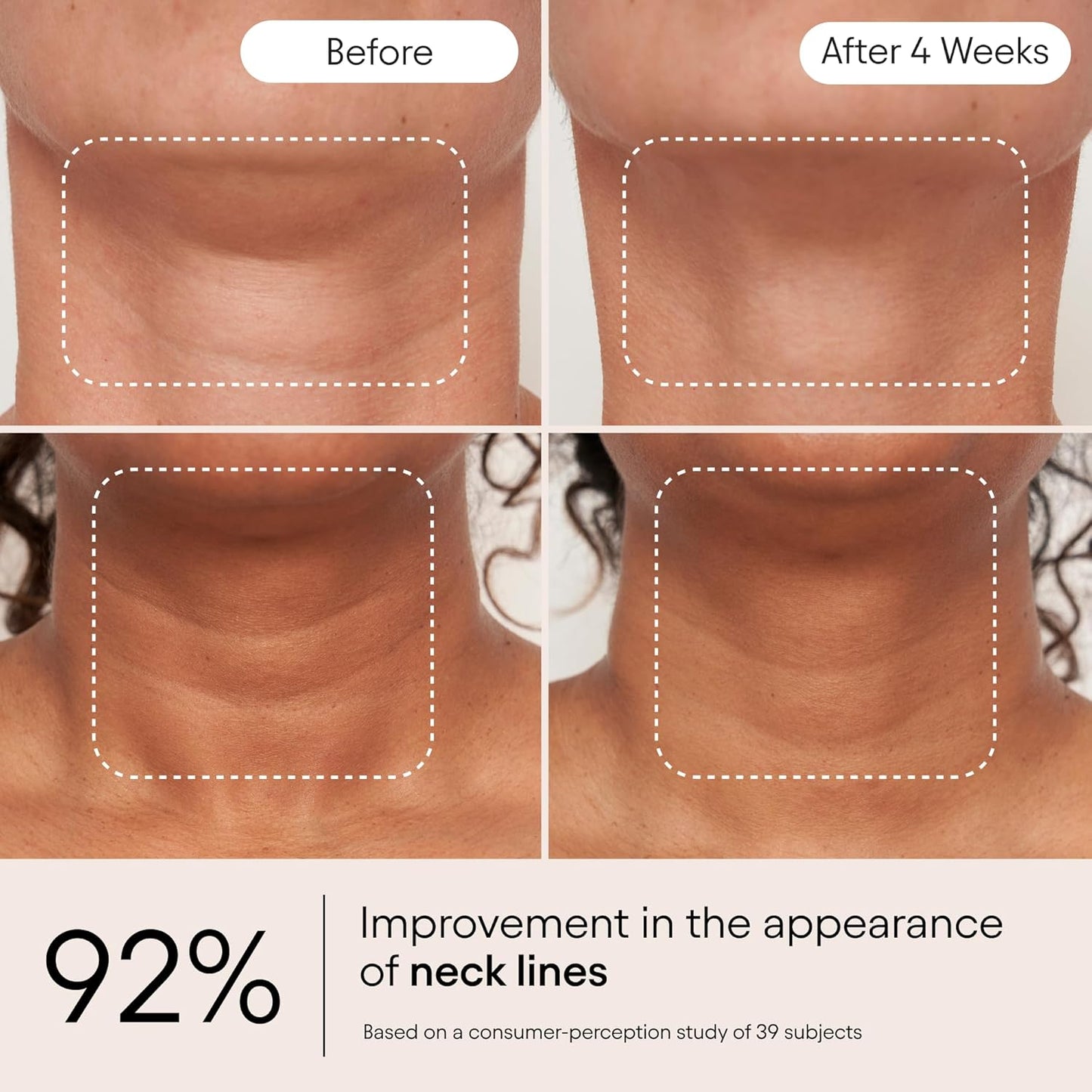 ALPYN Super Sculpt Serum, Face & Neck with Tri-Peptide Firming Complex, 1.7 oz