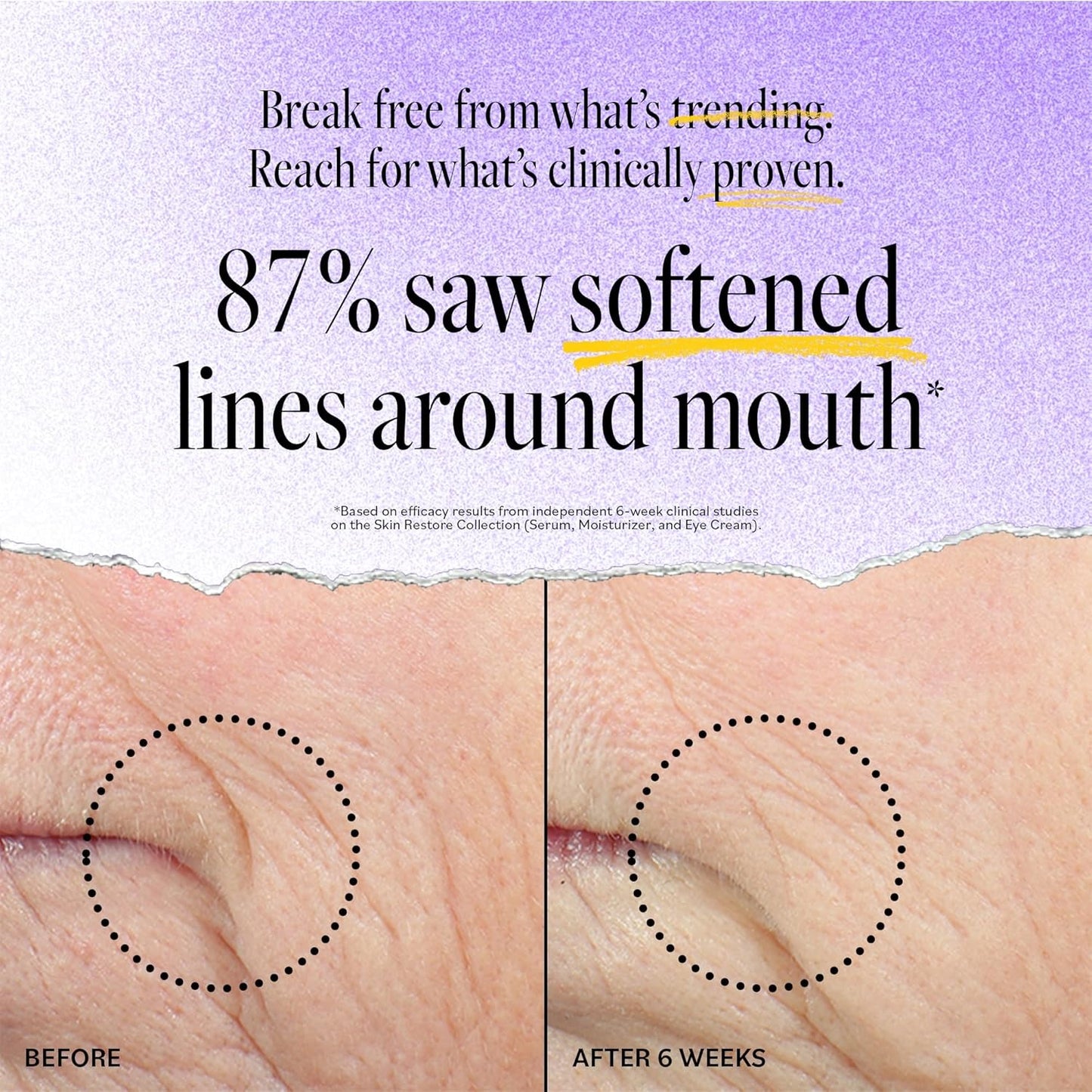 DERMA-E Advanced Peptides and Vegan Flora-Collagen Moisturizer – Double Action Collagen Face Cream with Peptide Complex – Skincare , 2 Oz